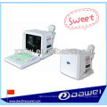 2 d máquina portátil de diagnóstico por ultrasonido